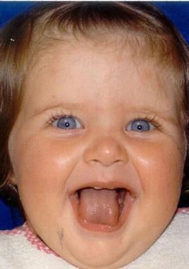 EVVIVA MATILDE!