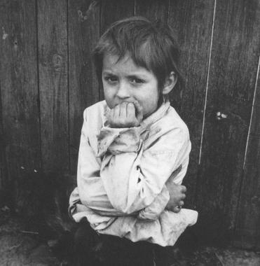 Un bambino di Chernobyl 