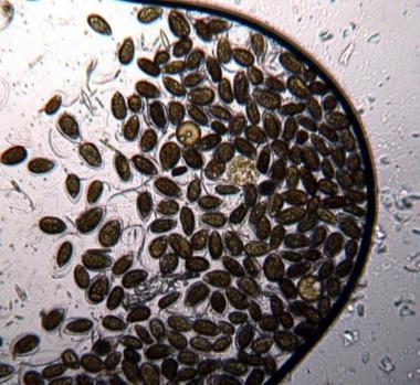Micro-alga tossica a Quercianella