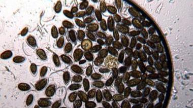 Micro-alga tossica a Quercianella
