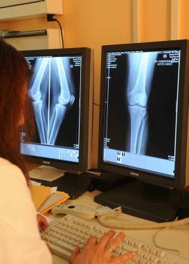 Adeguamenti in vista anche per le radiografie nellAsl 11    