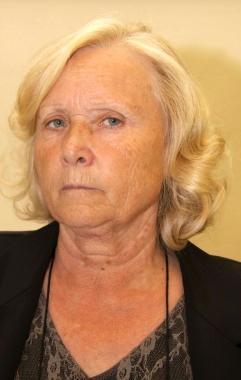 Lassessore Lombardi 