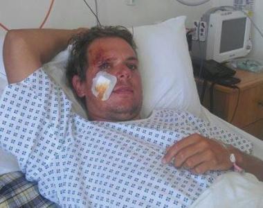 <b>FERITO.</b> Andrea Bernardi allospedale di Malta prima di tornare in Italia 