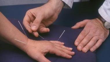 L’agopuntura è una medicina alternativa