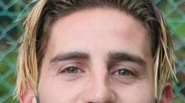 Artiaco
