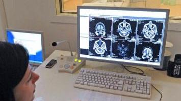 I monitor di controllo della Rmn