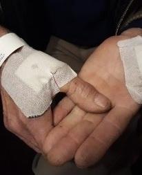 «Sono stato morso dai lupi» Ma non era vero: denunciato 