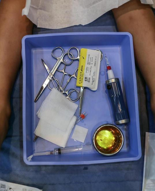 Circoncisione, guerra di perizie sul bimbo morto per il santone 