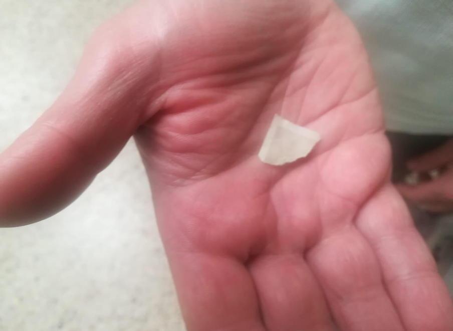 Il Comune “scagiona” Cirfood: «Non era cotta la carta negli spinaci» 