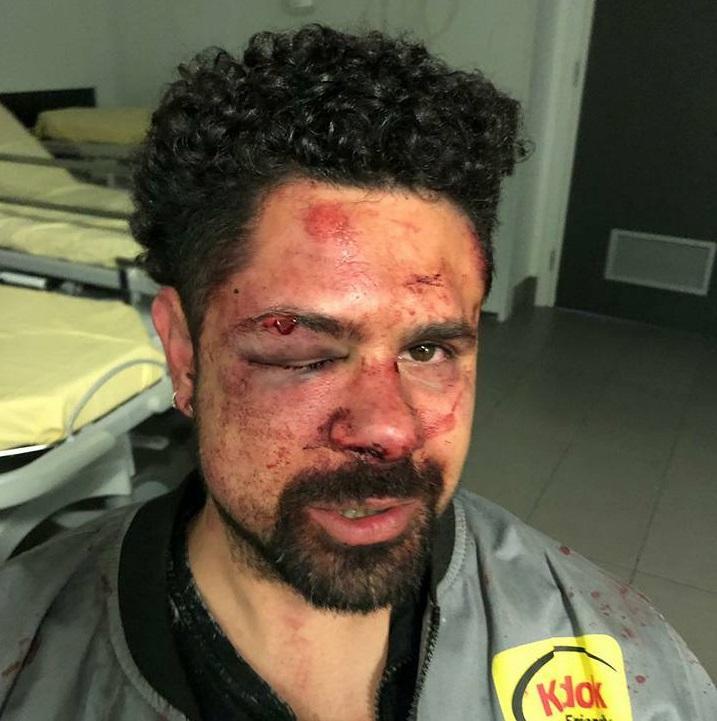 Carpi, parla la coppia pestata: «Abbiamo rischiato di morire Adesso prendeteli e metteteli in galera» 