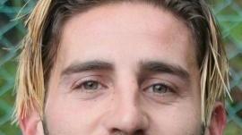 Artiaco