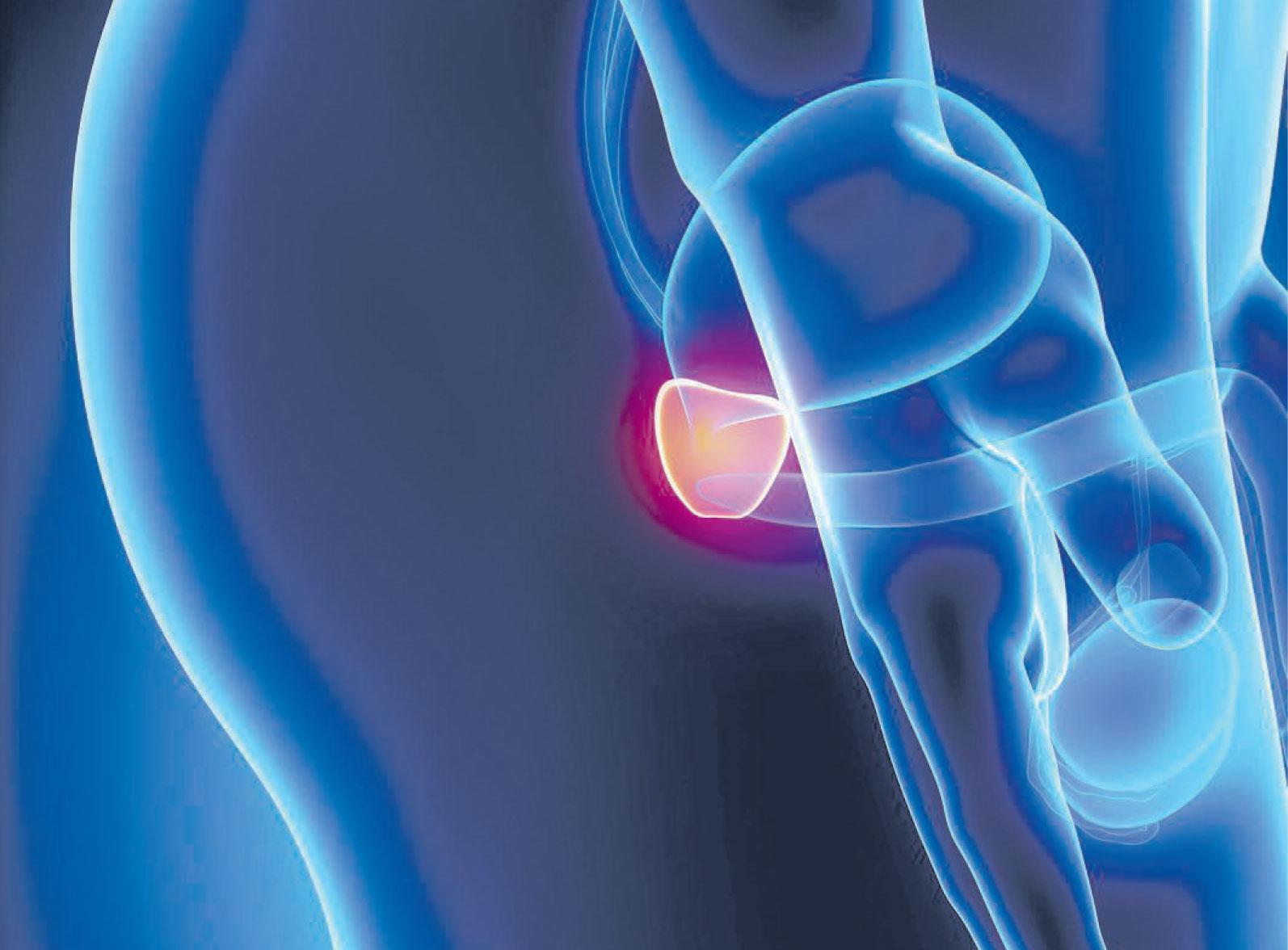 La prostata, questa (incredibile) sconosciuta: come si prevengono infiammazioni e tumori