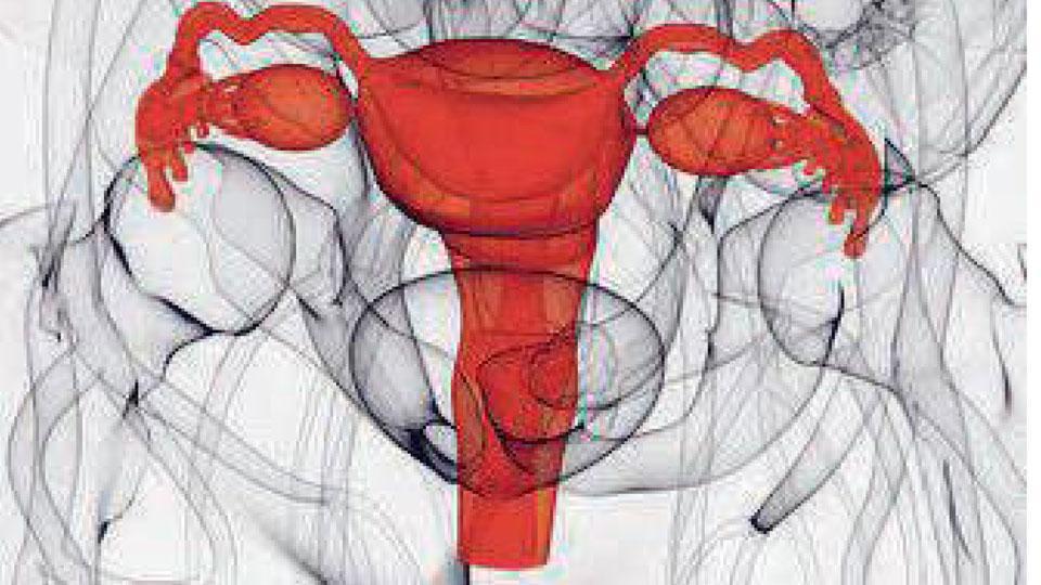 «Evitiamo di asportare l’utero, riducendo i vecchi interventi demolitivi»