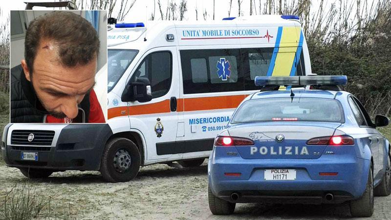Maurizio Marconi mostra la ferita all’attaccatura dei capelli