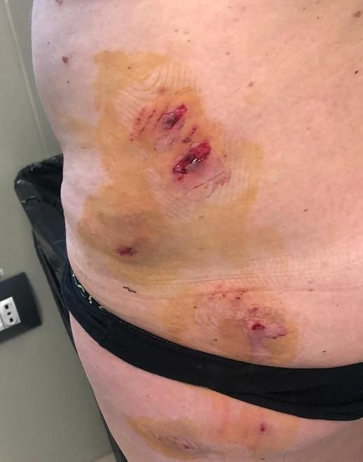 Aggredita da dobermann «Non avevo chiesto di poterlo accarezzare»
