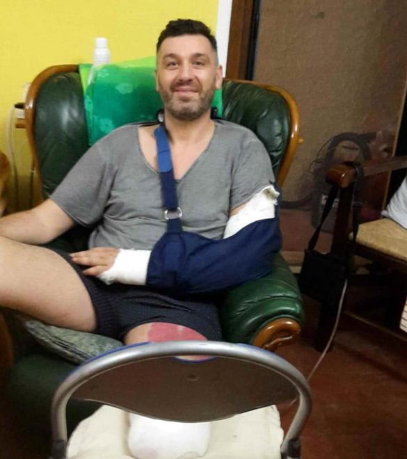 Sopravvissuto allo schianto in moto: «Senza la gamba, ma felice di essere vivo» 