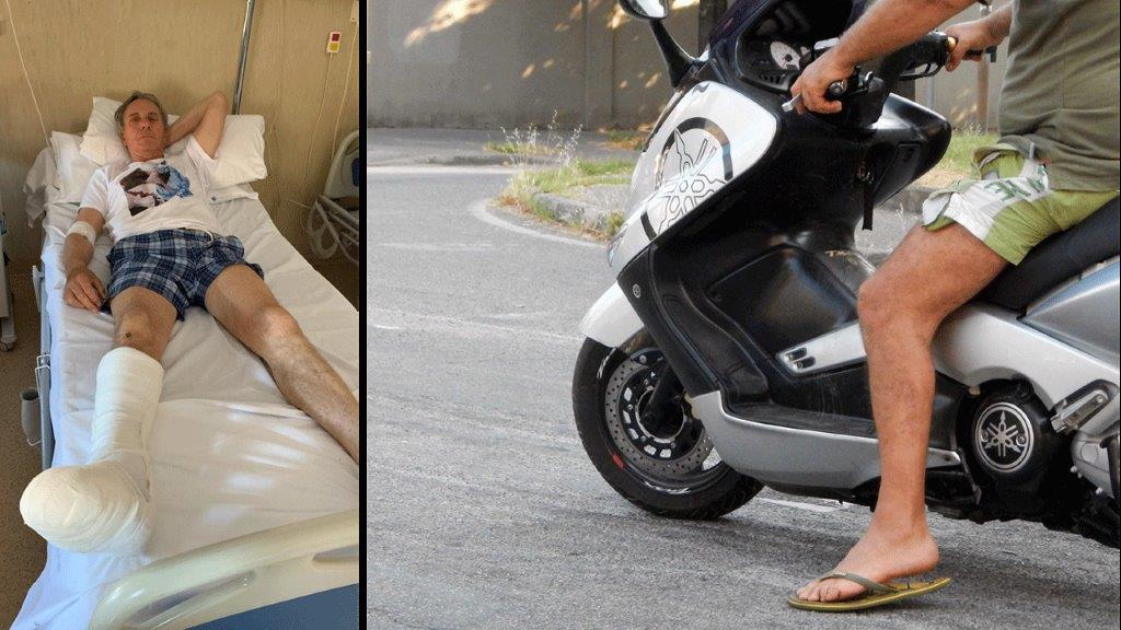 In scooter con le ciabatte contro un’auto: «Perderò un dito, ma ho rischiato il piede»
