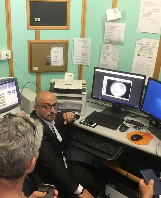 Diagnosi con il teleconsulto per intervenire più rapidamente 