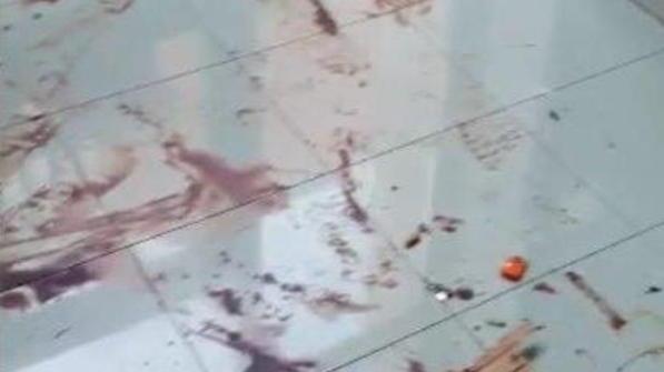 Furti e vandalismi in ospedale la polizia indaga sugli autori