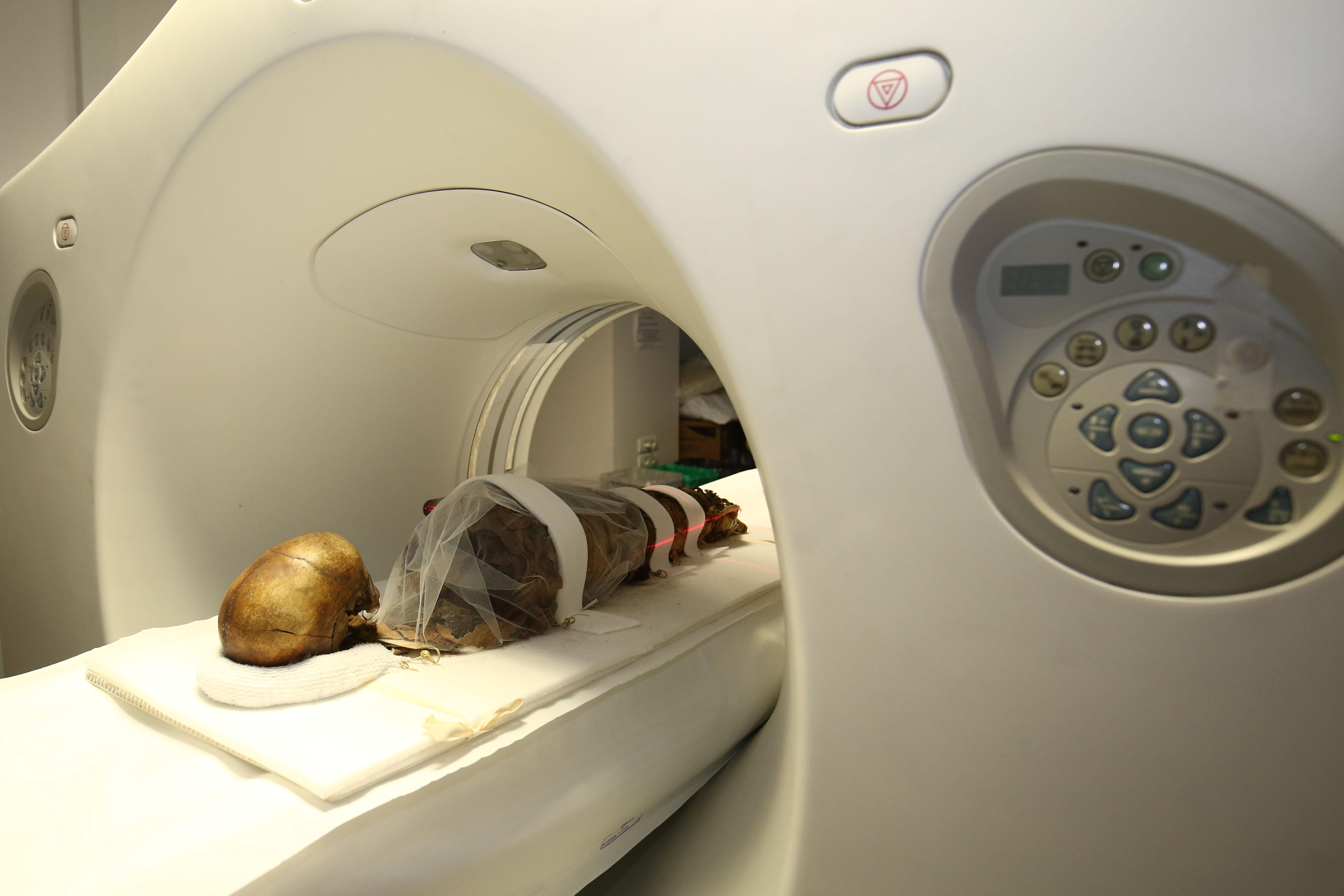 Modena. Il bambino mummia di 2mila anni fa adesso ha un volto ricostruito in 3D 