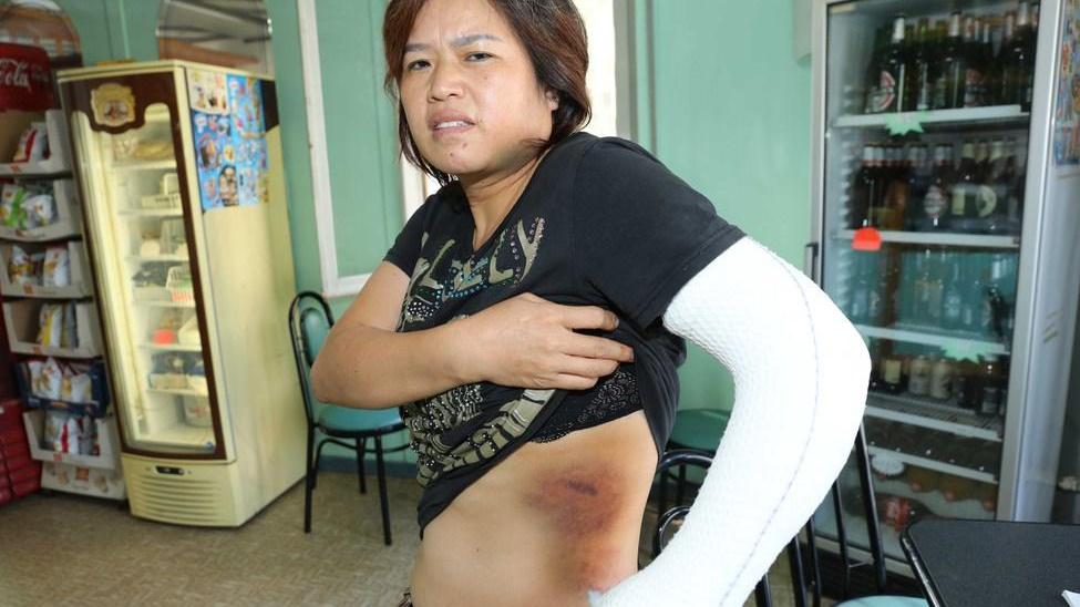 Follia a Cadè, 40 giorni di prognosi per la barista aggredita a mazzate