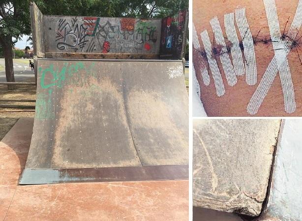 La pedana da skateboard dov'è caduto il bambino di 10 anni e, a destra, la ferita e un particolare delle lamiere