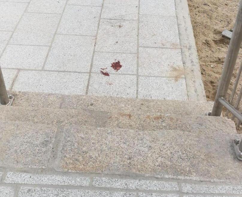 Morso da un cane sul molo del Giglio Carabiniere spara all’animale e lo uccide 