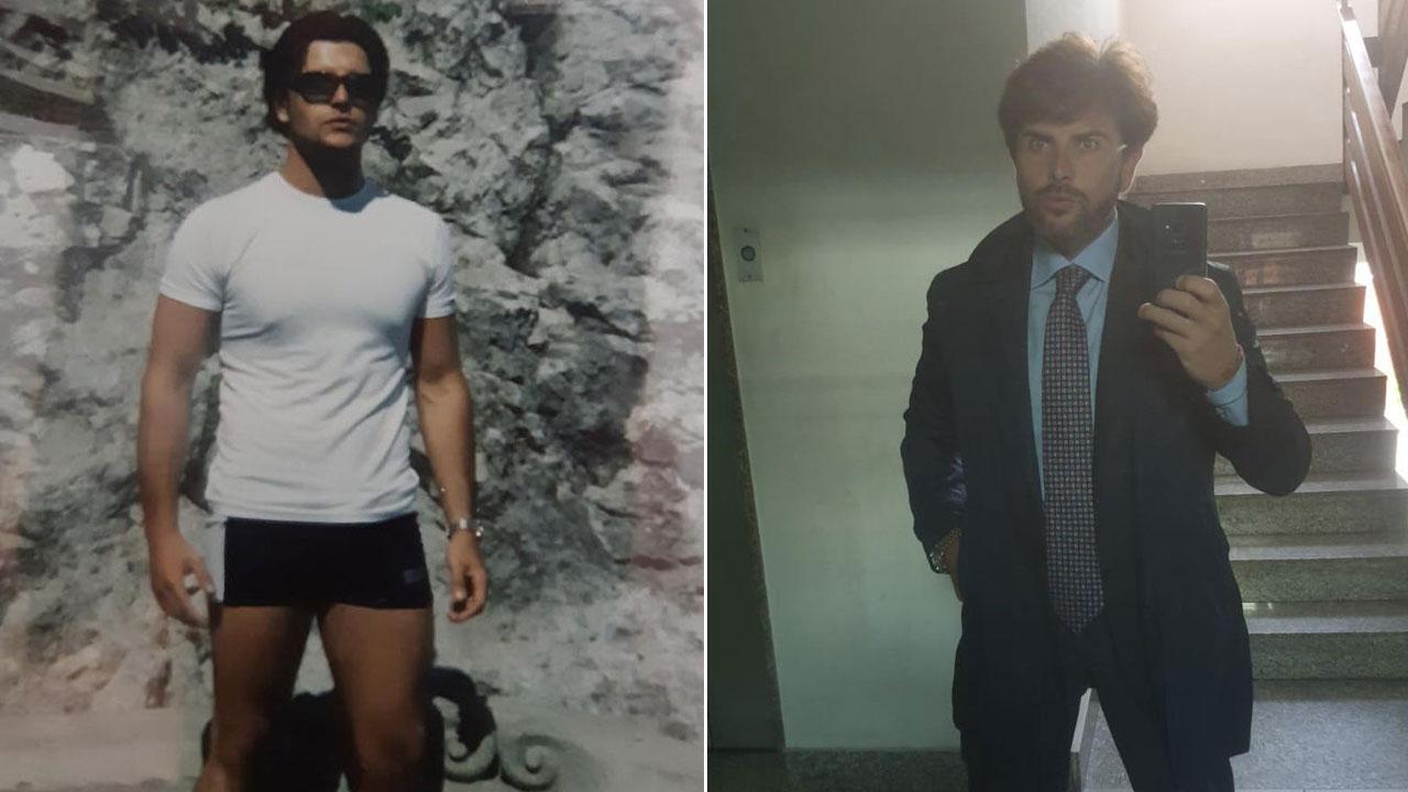 Carlo, il paziente che si è rivolto alla professoressa Brandi di Firenze: a sinistra prima della malattia quando era 1,84; a destra dopo l’intervento