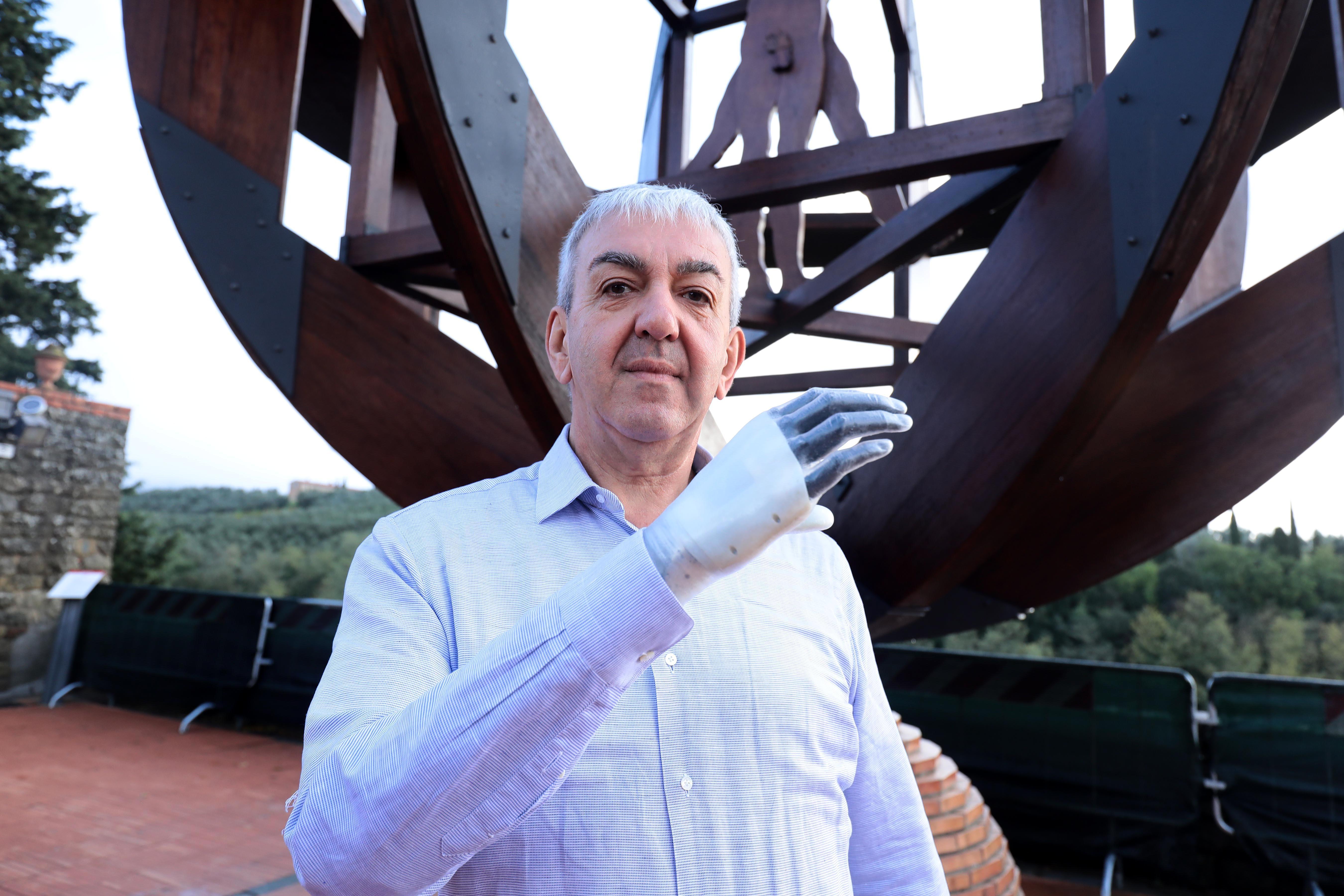 Marco Zambelli mostra la mano robotica (Foto Carlo Sestini)