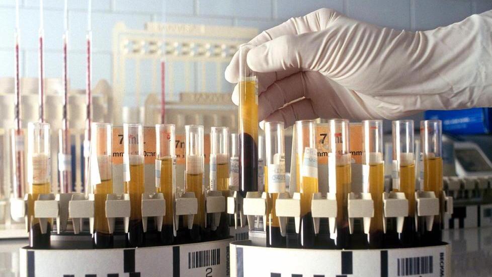 Un laboratorio per le analisi (foto d’archivio)