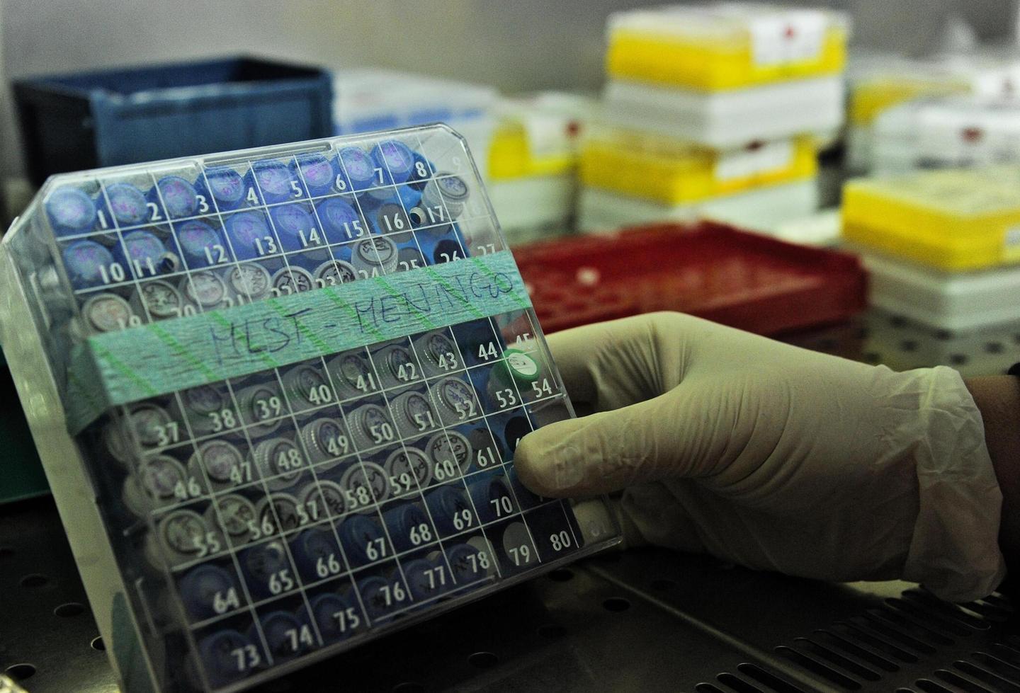 Meningite, muore una 14enne 