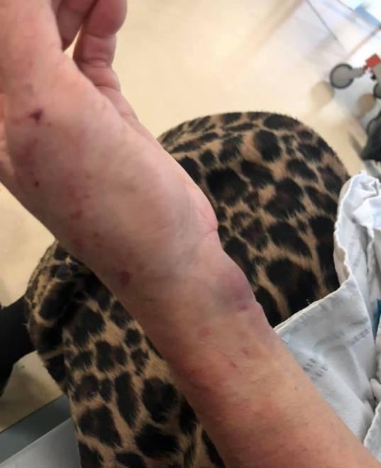 Modena, brutale rapina in ascensore per la gioielliera Blondi 