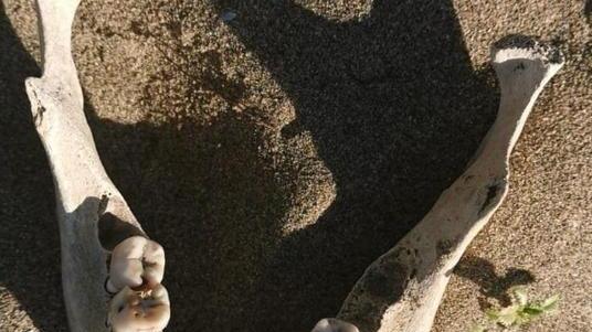 Mandibola trovata in spiaggia È di una donna tra 40 e 50 anni