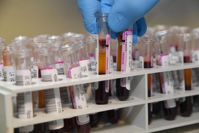 Coronavirus, in Sardegna scarseggiano i reagenti