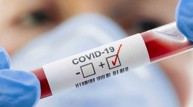 Coronavirus, muore a Cisanello un 71enne di Villa Basilica