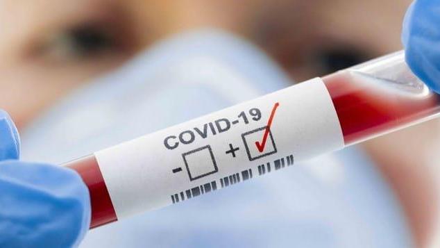 Coronavirus, muore a Cisanello un 71enne di Villa Basilica