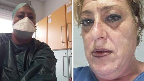 Tania Vaccai al lavoro e dopo uno degli estenuanti turni di questi giorni, dopo che si è tolta maschera e occhiali