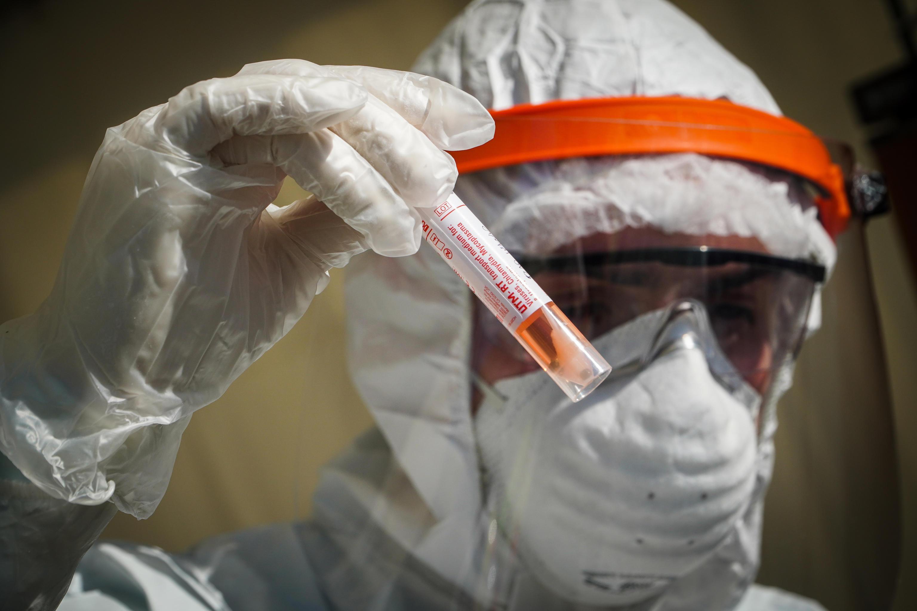 Uno studio analizza il virus: predilige il clima freddo secco 