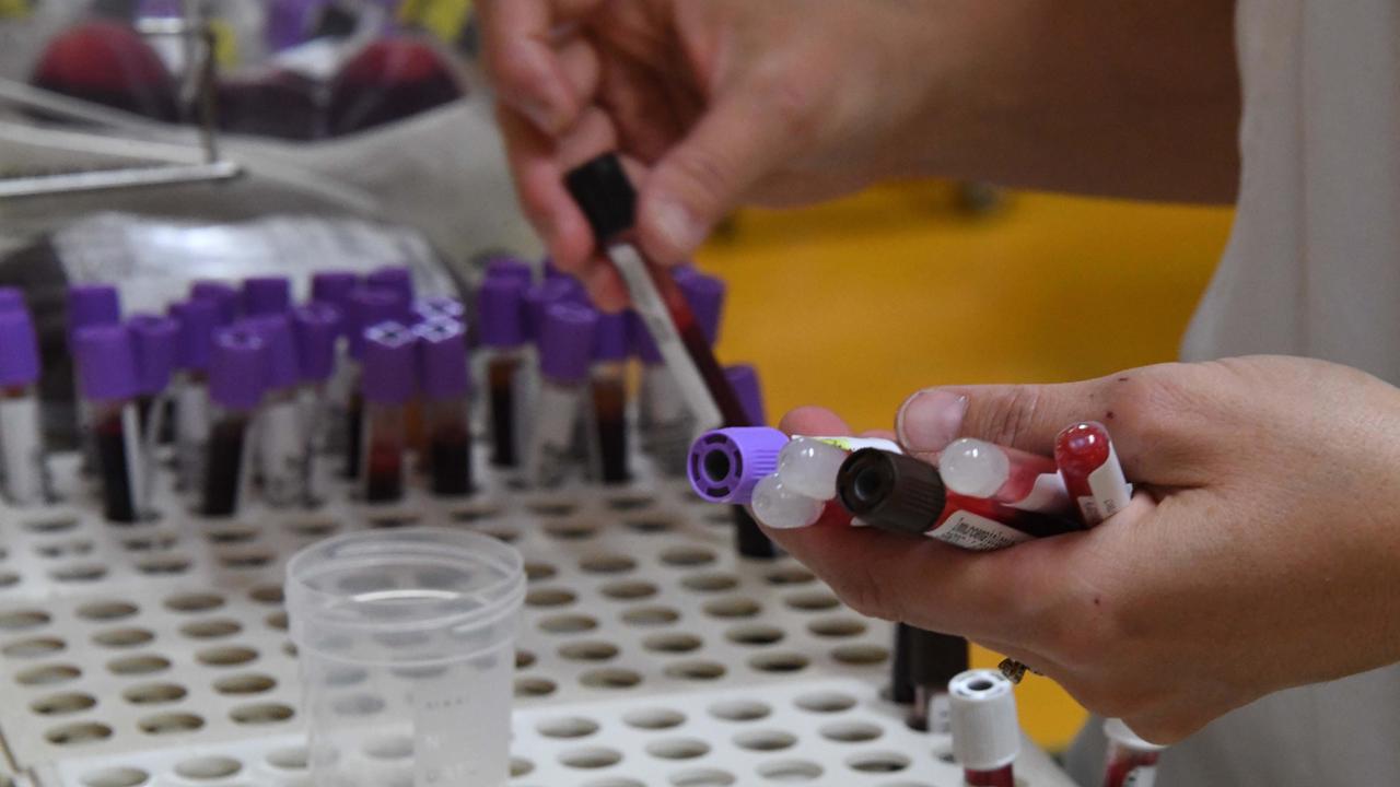 Provette di plasma in un laboratorio d'analisi (Foto Franco Silvi)