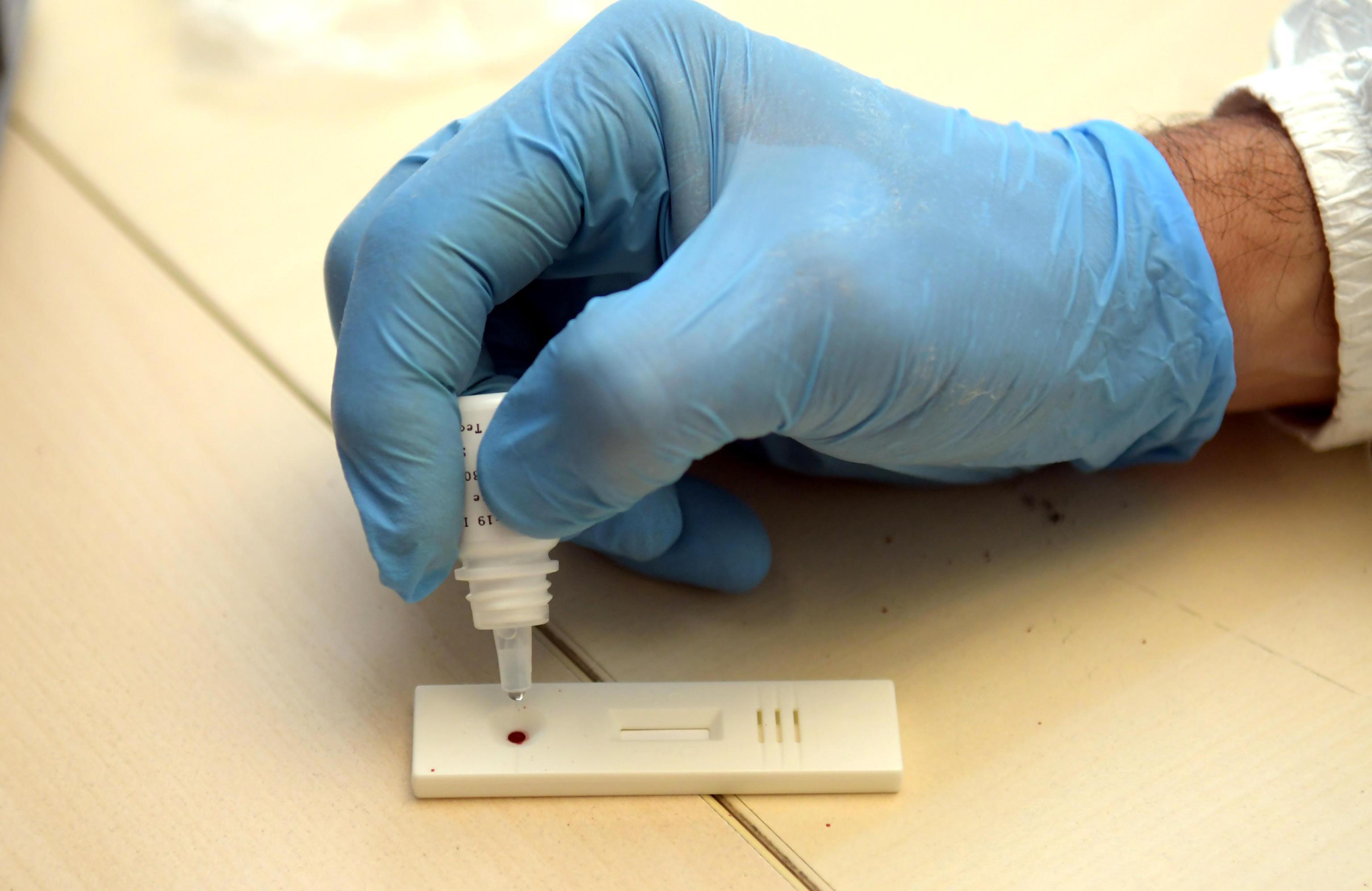 Coronavirus, retromarcia della Regione sui test sierologici privati