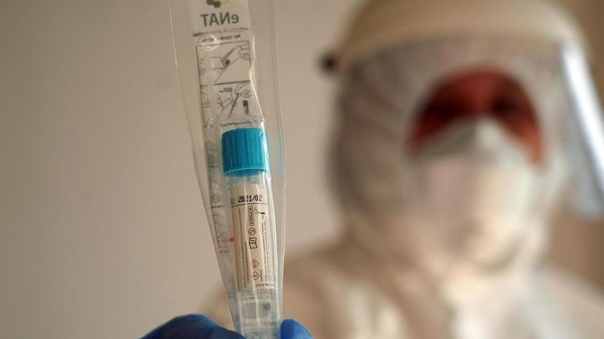 Un operatore sanitario con un test molecolare