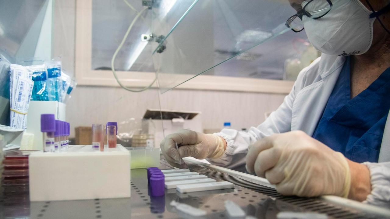 Un laboratorio di analisi (foto Serranò/Agf)