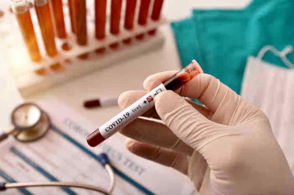 Coronavirus in Toscana: 52 nuovi casi, 16 decessi e 123 guarigioni 