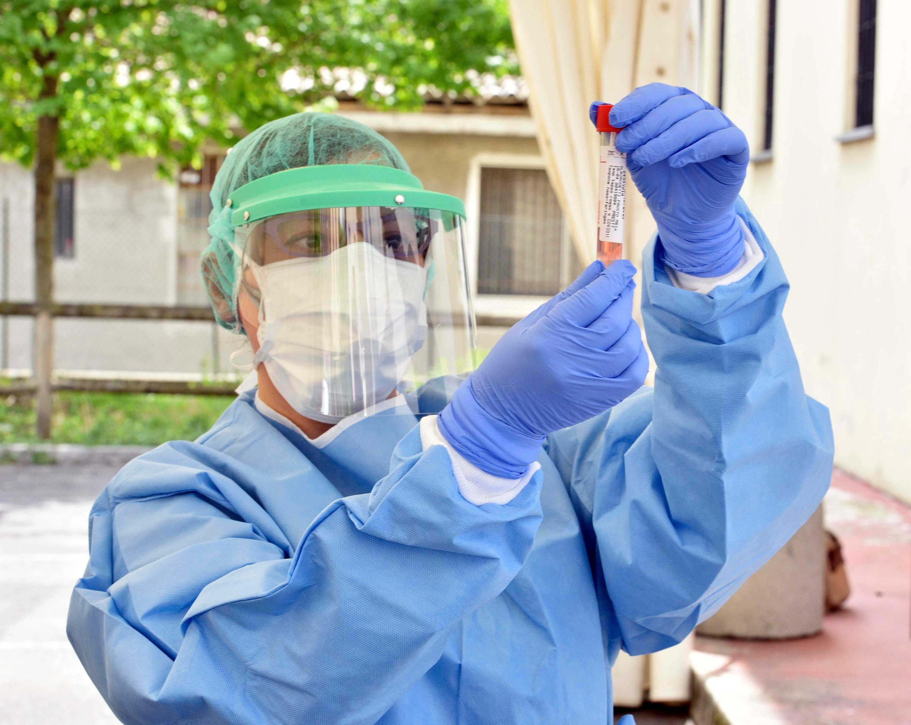 Coronavirus, Cisl: agente di polizia locale di Sassari positivo ma al lavoro 
