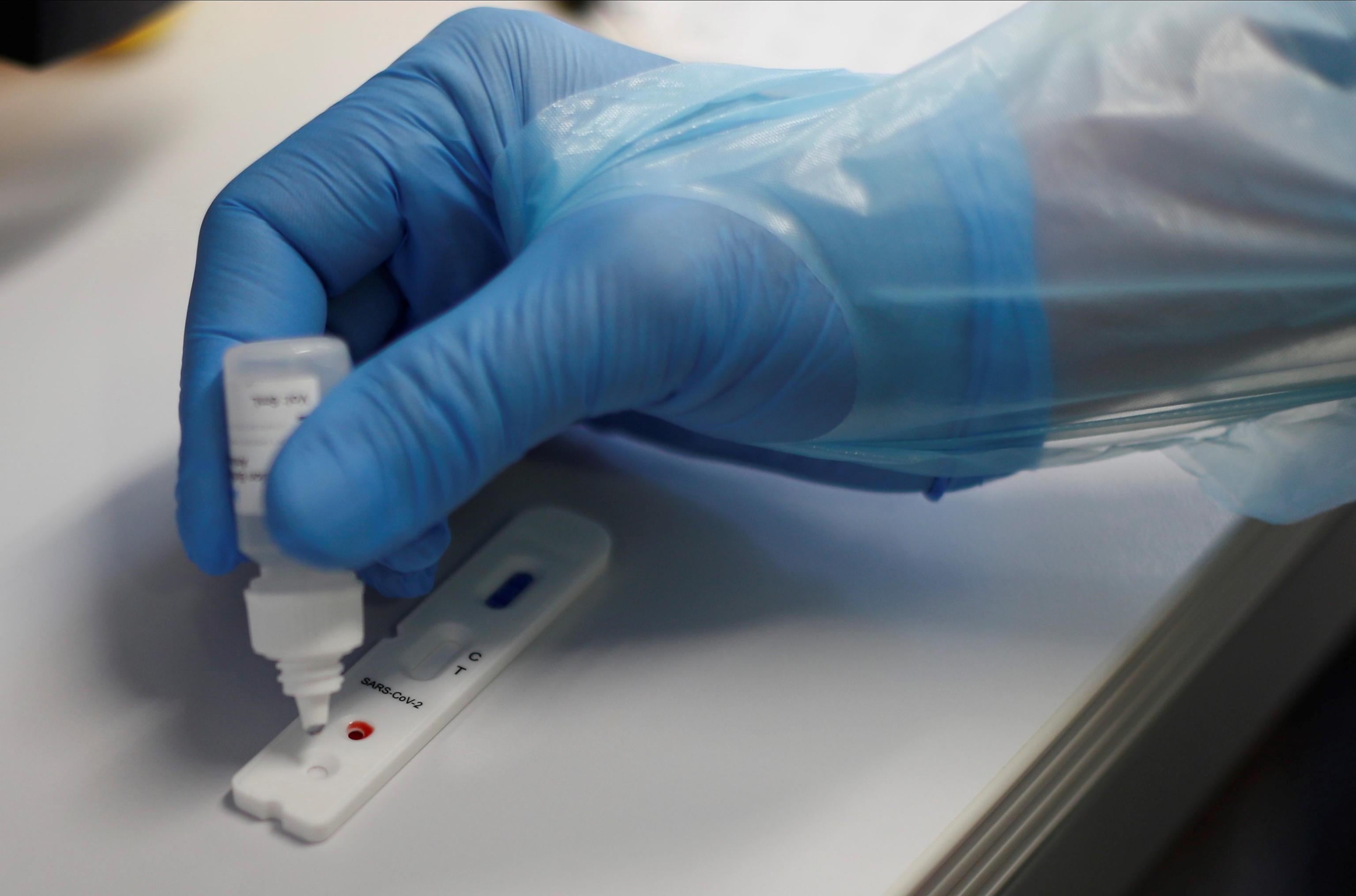 Test anticorpali nell'isola: via dalla prossima settimana in 4 centri 