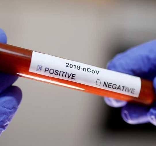 Test sierologici a pagamento La Regione bacchetta il medico 