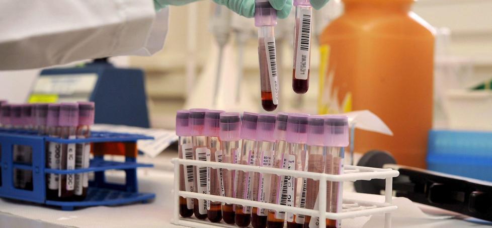Sierologici, i positivi a Lucca tra il 5 e il 10%. Tampone in giornata per chi è a rischio 