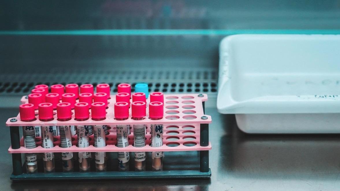 Laboratorio analisi: le provette con i tamponi