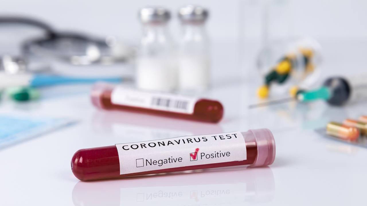 Coronavirus: in Toscana 24 nuovi casi, 7 decessi e 272 guarigioni