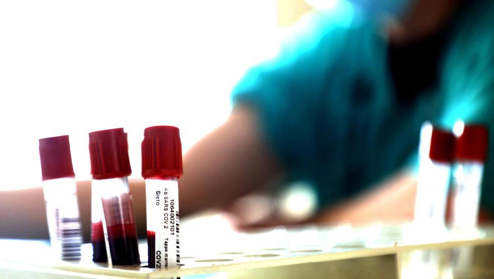 Test sierologico con la prescrizione del medico o a pagamento